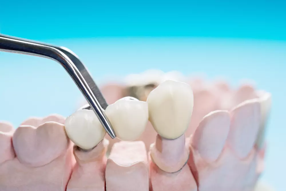 Artificial Teeth